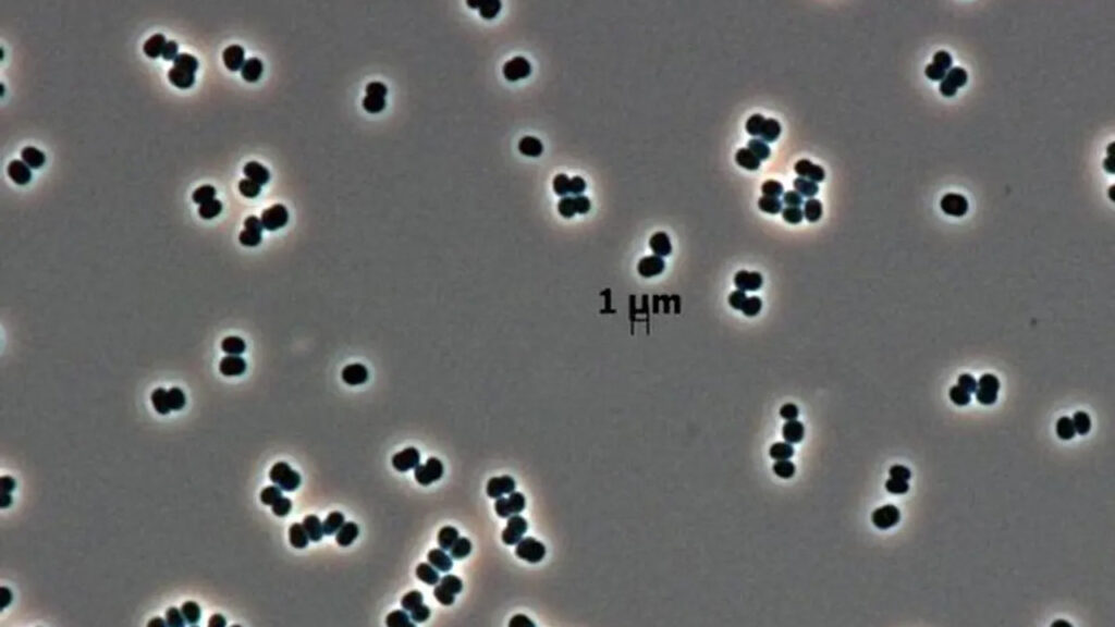 olu taklidi yapan super bakteriler uzayi bile tehdit ediyor WarnQ6ln.jpg